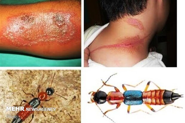 حمله دراکولا به اندیکا/ «پادروس» حشره‌ای با نقاب مورچه